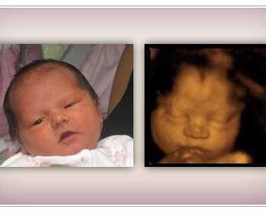 early-baby-insights-dna-gender-test-services-in-anaheim