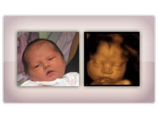 early-baby-insights-dna-gender-test-services-in-anaheim-small-0