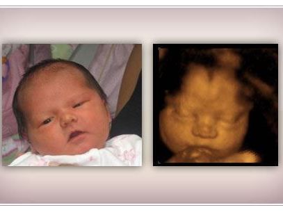 early-baby-insights-dna-gender-test-services-in-anaheim