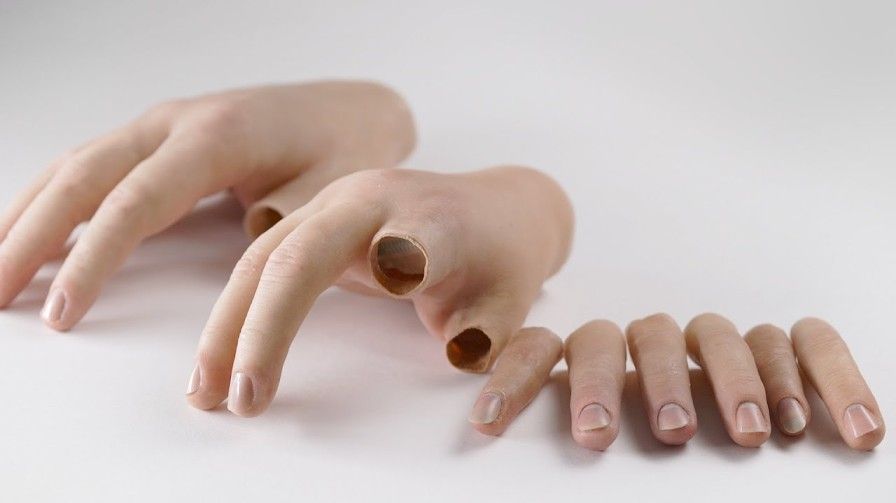 partial-hand-prosthetics-cost-guide-and-custom-options-big-0