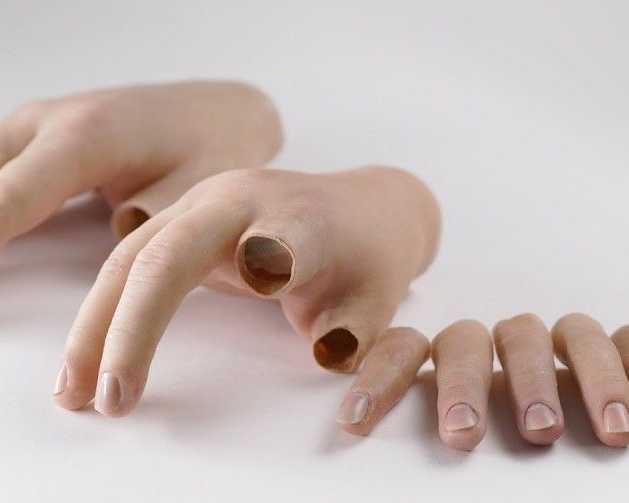 partial-hand-prosthetics-cost-guide-and-custom-options