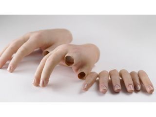 partial-hand-prosthetics-cost-guide-and-custom-options-small-0