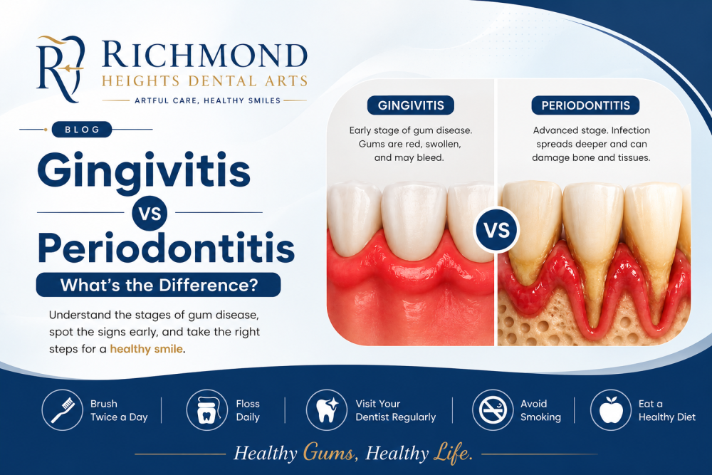 what-is-the-difference-between-gingivitis-vs-periodontitis-big-0