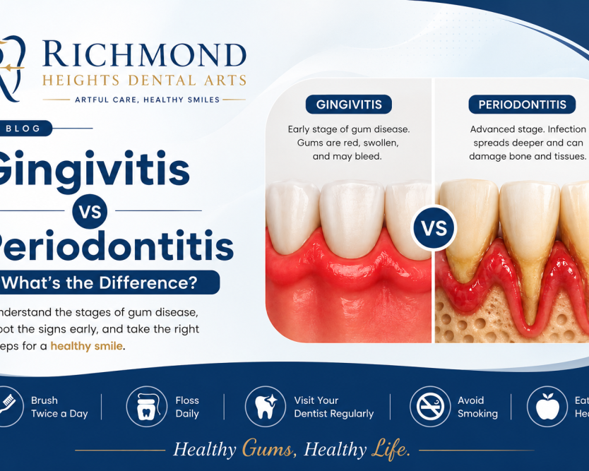 what-is-the-difference-between-gingivitis-vs-periodontitis