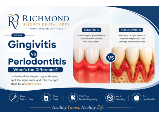 what-is-the-difference-between-gingivitis-vs-periodontitis-small-0