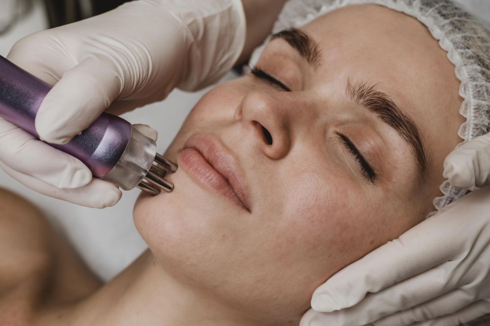 younger-looking-skin-with-microneedling-in-norfolk-va-big-0