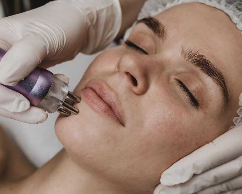 younger-looking-skin-with-microneedling-in-norfolk-va