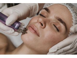 younger-looking-skin-with-microneedling-in-norfolk-va-small-0