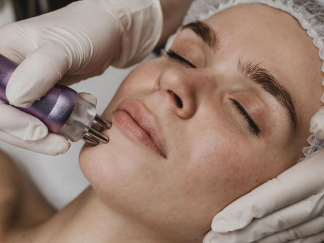 younger-looking-skin-with-microneedling-in-norfolk-va