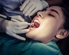 affordable-root-canal-treatment-phoenix