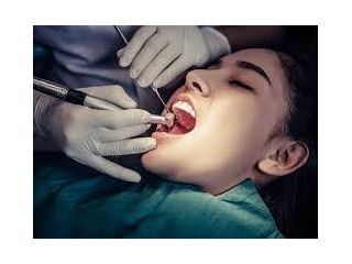 affordable-root-canal-treatment-phoenix-small-0