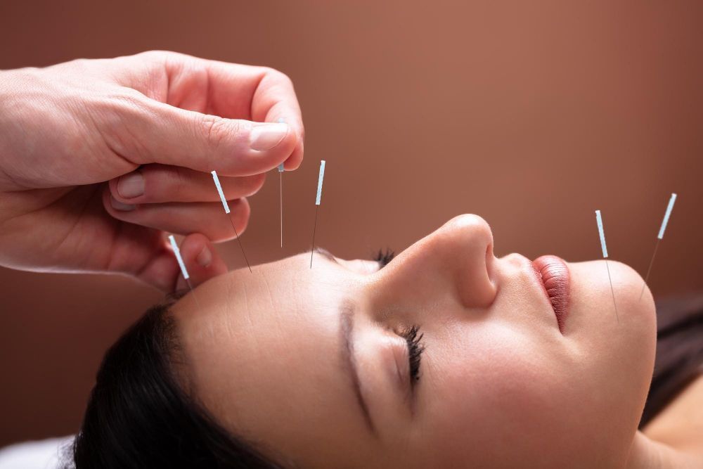 top-rated-acupuncture-clinic-in-pembroke-pines-big-0