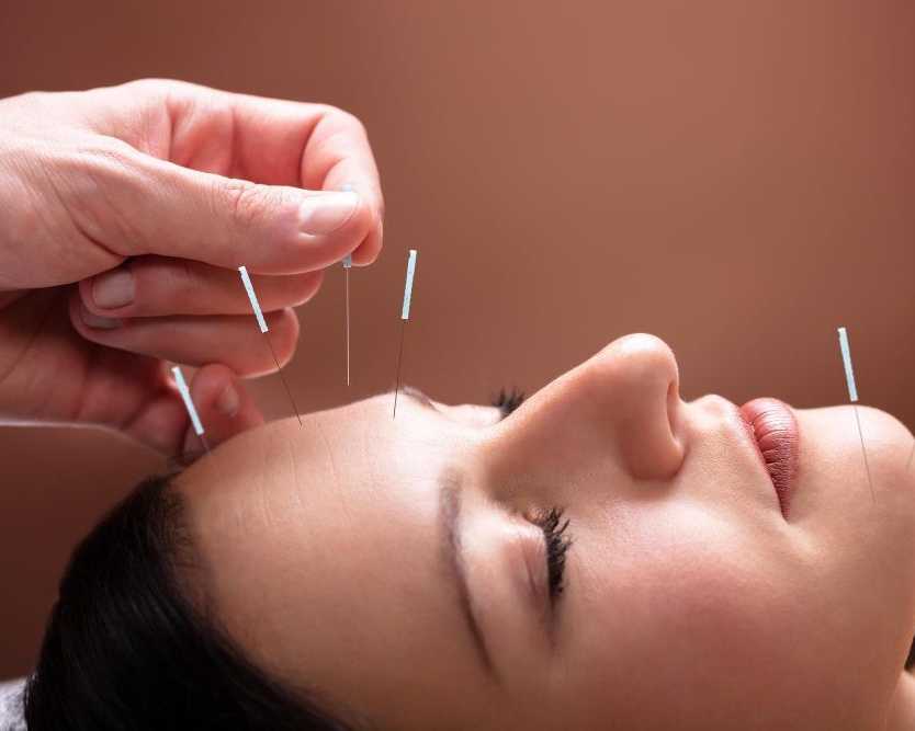 top-rated-acupuncture-clinic-in-pembroke-pines