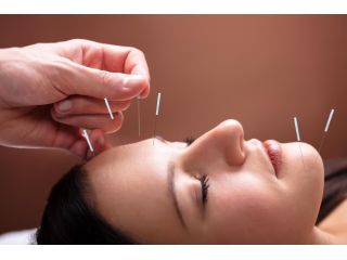 top-rated-acupuncture-clinic-in-pembroke-pines-small-0