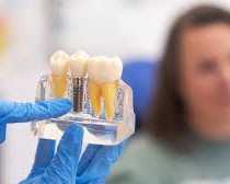 missing-teeth-restore-your-smile-with-affordable-dental-implants