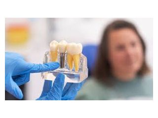 missing-teeth-restore-your-smile-with-affordable-dental-implants-small-0