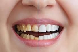 affordable-chandler-cosmetic-dentistry-big-0