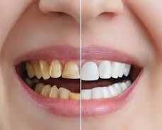 affordable-chandler-cosmetic-dentistry
