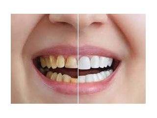 affordable-chandler-cosmetic-dentistry-small-0