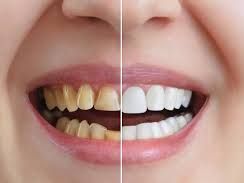 affordable-chandler-cosmetic-dentistry