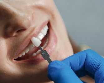 dental-implants-in-mesa-az-for-a-confident-smile