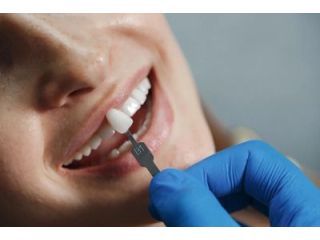 dental-implants-in-mesa-az-for-a-confident-smile-small-0