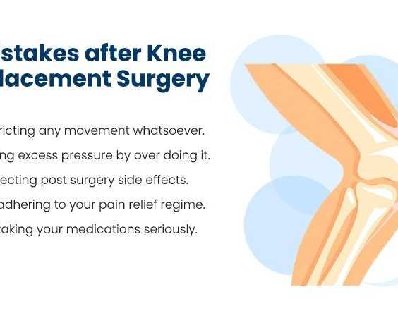 what-to-expect-after-knee-replacement-surgery