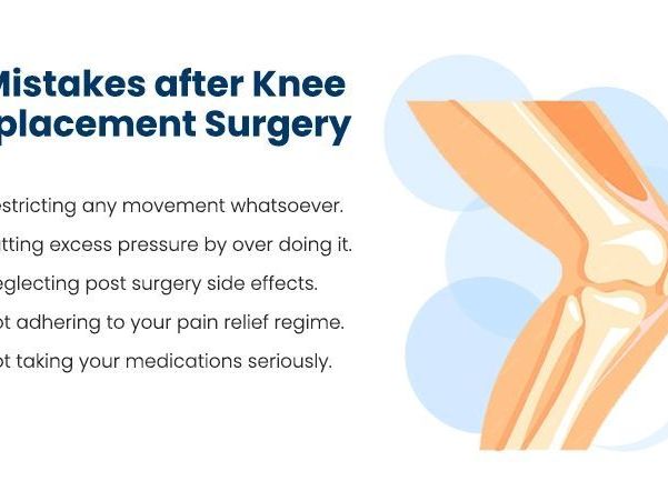 what-to-expect-after-knee-replacement-surgery