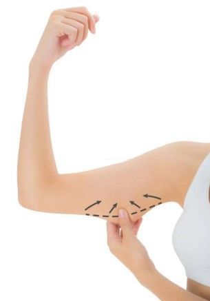 complete-guide-to-non-surgical-body-contouring-big-0
