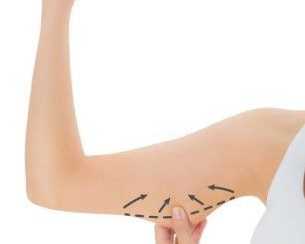 complete-guide-to-non-surgical-body-contouring