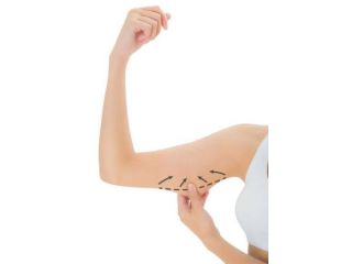 complete-guide-to-non-surgical-body-contouring-small-0
