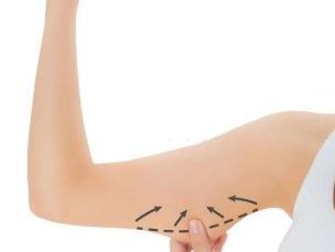 complete-guide-to-non-surgical-body-contouring