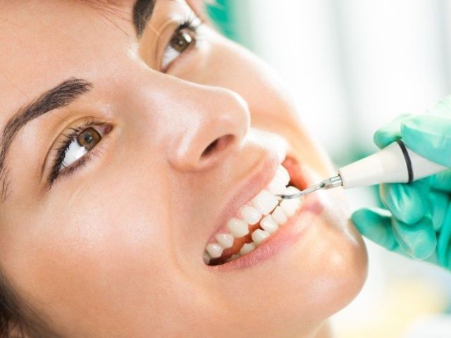 best-teeth-cleaning-downtown-seattle-with-experienced-dental-team
