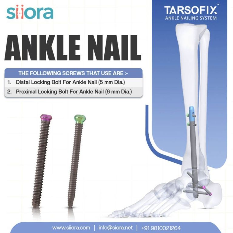 precision-that-moves-you-forward-ankle-nail-solutions-by-siora-big-0