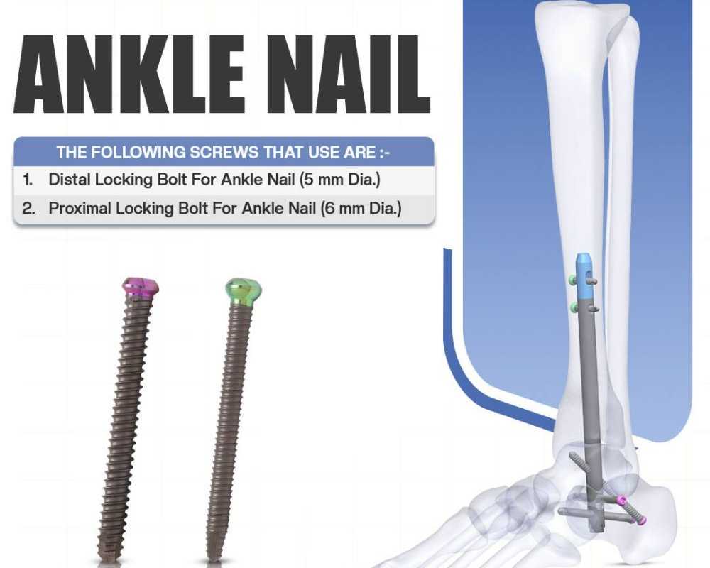 precision-that-moves-you-forward-ankle-nail-solutions-by-siora