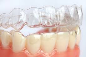get-a-perfect-smile-invisalign-braces-near-me-big-0