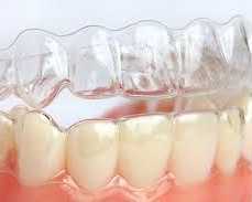 get-a-perfect-smile-invisalign-braces-near-me