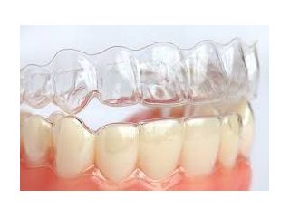 get-a-perfect-smile-invisalign-braces-near-me-small-0