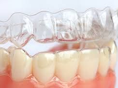 get-a-perfect-smile-invisalign-braces-near-me