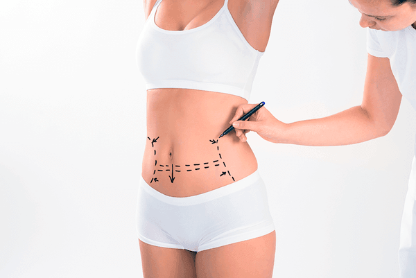 advanced-care-for-liposuction-fibrosis-big-1