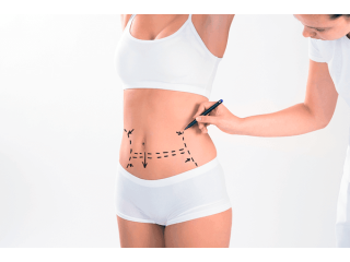 advanced-care-for-liposuction-fibrosis-small-1