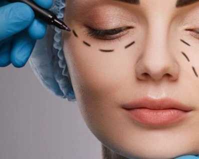 eyelid-surgery-blepharoplasty-treatment-in-seattle-washington