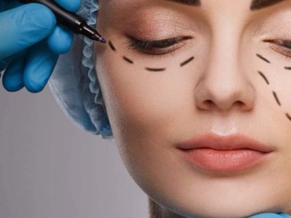 eyelid-surgery-blepharoplasty-treatment-in-seattle-washington