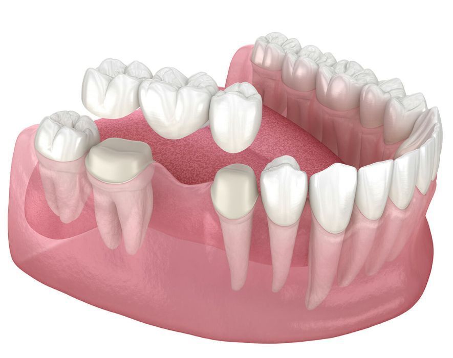 precision-dental-surgeons-expert-oral-care-in-lahore-big-0