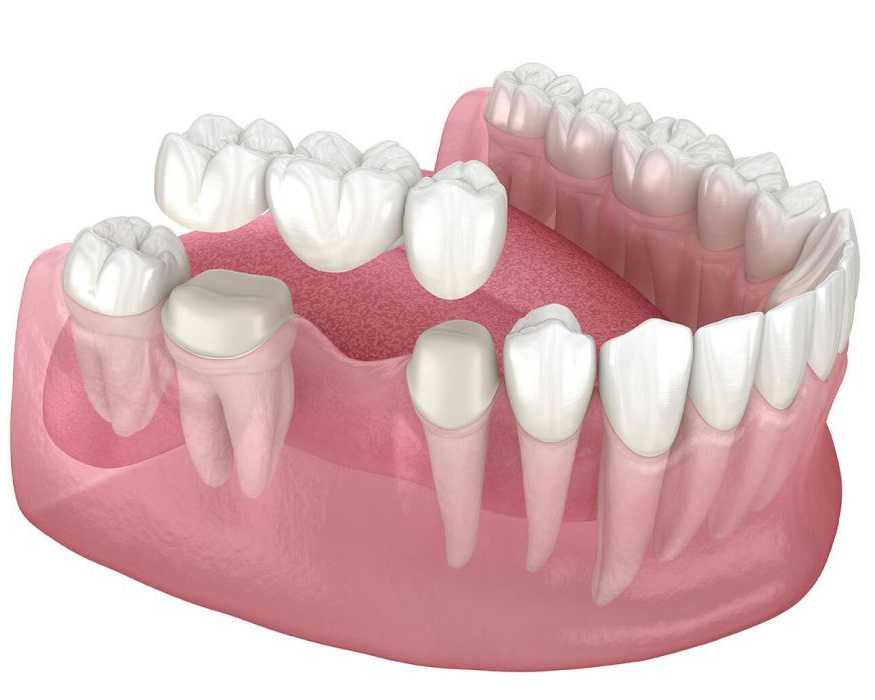 precision-dental-surgeons-expert-oral-care-in-lahore