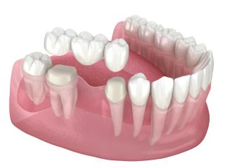 precision-dental-surgeons-expert-oral-care-in-lahore-small-0