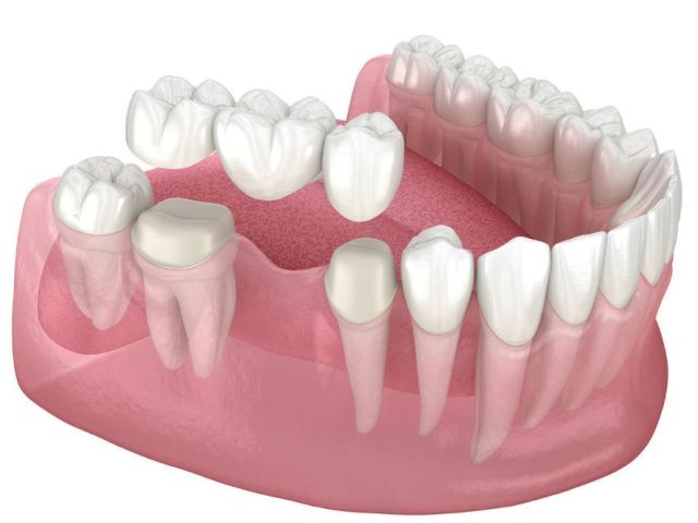 precision-dental-surgeons-expert-oral-care-in-lahore