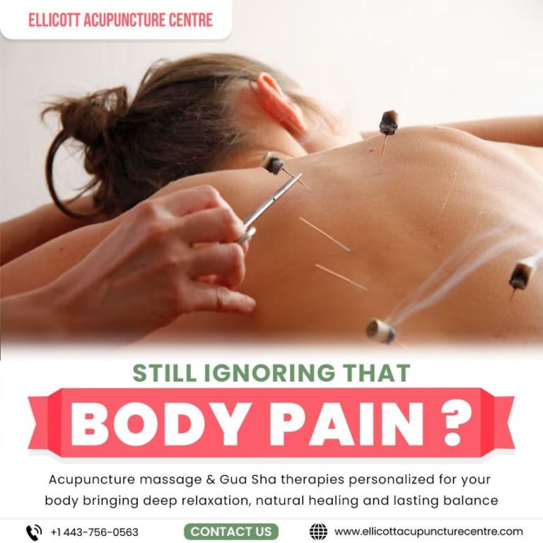 nerve-acupuncture-treatment-for-pain-relief-in-ellicott-city-md-big-0