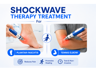 plantar-fasciitis-treatment-in-sarasota-fl-fast-pain-relief-small-0