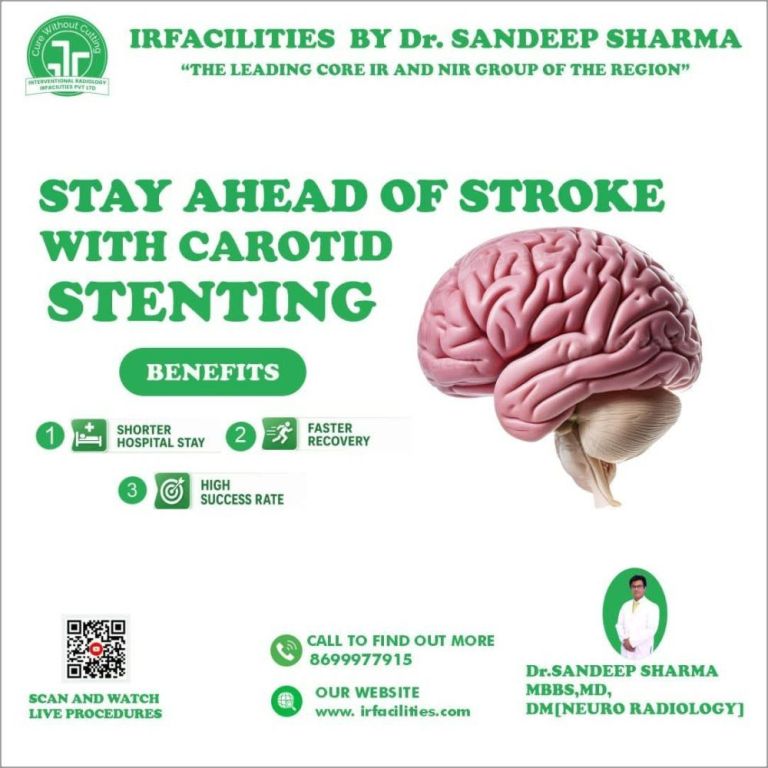 carotid-artery-stenosis-treatment-for-better-brain-functioning-big-0